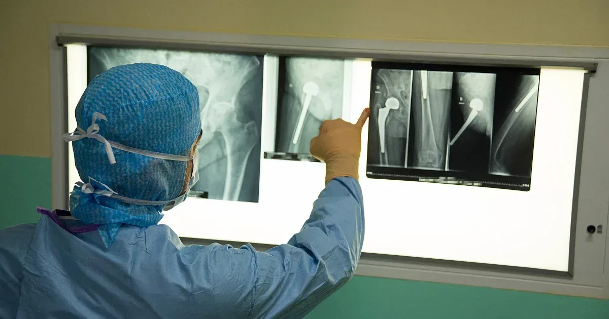 A várólisták rövidítéséhez elsősorban pénz kell, a műtétek késésének több oka is lehet